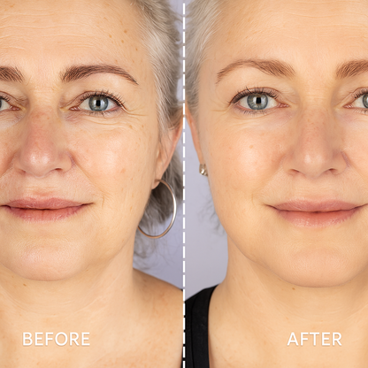 Elunori - LED Face Mask